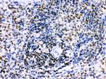 IKAROS Antibody in Immunohistochemistry (Paraffin) (IHC (P))