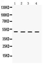 LCAT Antibody in Western Blot (WB)