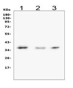 Galectin 8 Antibody in Western Blot (WB)