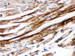 SHP2 Antibody in Immunohistochemistry (Paraffin) (IHC (P))