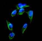 GRK3 Antibody in Immunocytochemistry (ICC/IF)