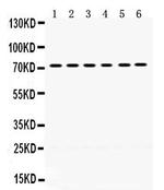 LIMK2 Antibody in Western Blot (WB)