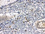 MMP8 Antibody in Immunohistochemistry (Paraffin) (IHC (P))