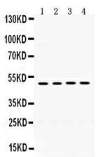 n-Myc Antibody in Western Blot (WB)