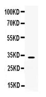 TREX1 Antibody in Western Blot (WB)