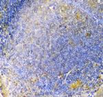 Alix Antibody in Immunohistochemistry (Paraffin) (IHC (P))