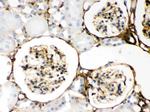 Galectin 1 Antibody in Immunohistochemistry (Paraffin) (IHC (P))