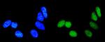 RAB9 Antibody in Immunocytochemistry (ICC/IF)