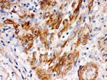 SFRP4 Antibody in Immunohistochemistry (Paraffin) (IHC (P))