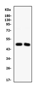 SFRP4 Antibody in Western Blot (WB)