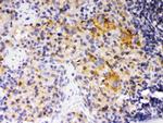 SKAP55 Antibody in Immunohistochemistry (Paraffin) (IHC (P))