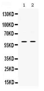 SKAP55 Antibody in Western Blot (WB)