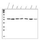 SPTLC1 Antibody in Western Blot (WB)