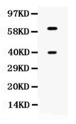 CLN2 Antibody in Western Blot (WB)