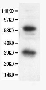 Bcl-X Antibody in Western Blot (WB)