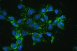 Catalase Antibody in Immunocytochemistry (ICC/IF)