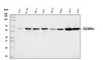 Catalase Antibody in Western Blot (WB)