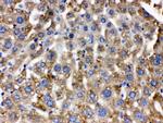 Catalase Antibody in Immunohistochemistry (Paraffin) (IHC (P))