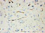 Calcitonin Antibody in Immunohistochemistry (Paraffin) (IHC (P))