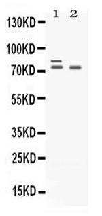 PLZF Antibody in Western Blot (WB)