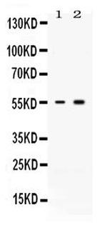 ACVR2B Antibody in Western Blot (WB)