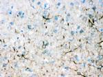 alpha Internexin Antibody in Immunohistochemistry (Paraffin) (IHC (P))