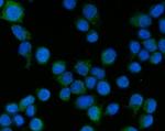 TAK1 Antibody in Immunocytochemistry (ICC/IF)