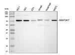 TAK1 Antibody in Western Blot (WB)