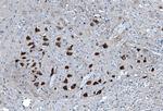 TPL2 Antibody in Immunohistochemistry (Paraffin) (IHC (P))