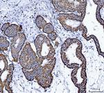 ALDH1B1 Antibody in Immunohistochemistry (Paraffin) (IHC (P))