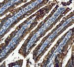 ALDH1B1 Antibody in Immunohistochemistry (Paraffin) (IHC (P))