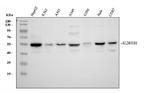 ALDH1B1 Antibody in Western Blot (WB)