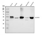 ALDH1B1 Antibody in Western Blot (WB)