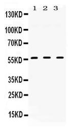 TGFBR1 Antibody in Western Blot (WB)