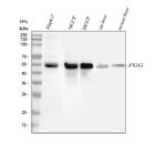 Fibrinogen gamma Antibody in Western Blot (WB)