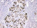 Fibrinogen gamma Antibody in Immunohistochemistry (Paraffin) (IHC (P))