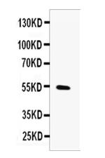 MMP13 Antibody in Western Blot (WB)