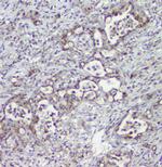 MPI Antibody in Immunohistochemistry (Paraffin) (IHC (P))