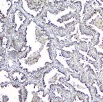 MPI Antibody in Immunohistochemistry (Paraffin) (IHC (P))