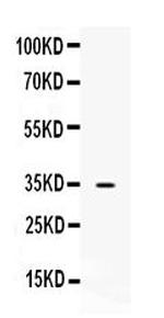 NAT1 Antibody in Western Blot (WB)