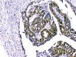 Survivin Antibody in Immunohistochemistry (Paraffin) (IHC (P))