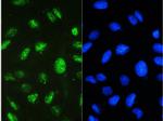 STAT1 Antibody in Immunocytochemistry (ICC/IF)