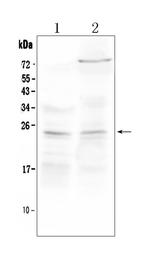 TIMP3 Antibody in Western Blot (WB)