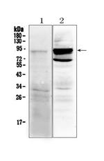 TLR2 Antibody in Western Blot (WB)