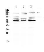 IL17RA Antibody in Western Blot (WB)