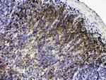 Lyn Antibody in Immunohistochemistry (Paraffin) (IHC (P))