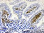 Lyn Antibody in Immunohistochemistry (Paraffin) (IHC (P))