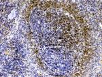 Lyn Antibody in Immunohistochemistry (Paraffin) (IHC (P))