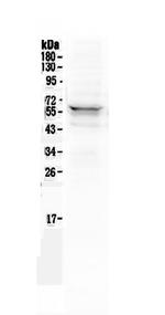 Lyn Antibody in Western Blot (WB)