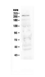 NOTCH1 Antibody in Western Blot (WB)